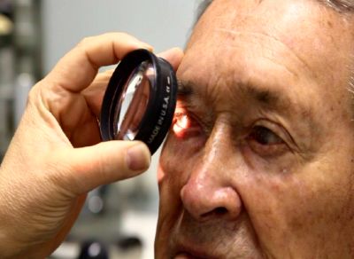 La degeneración macular afecta a personas mayores de 60 años, pero cada vez más se diagnostica en personas jóvenes.